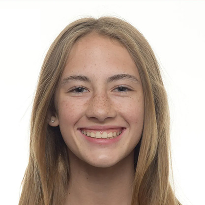 Before_Gingivectomy Before_Gingivectomy