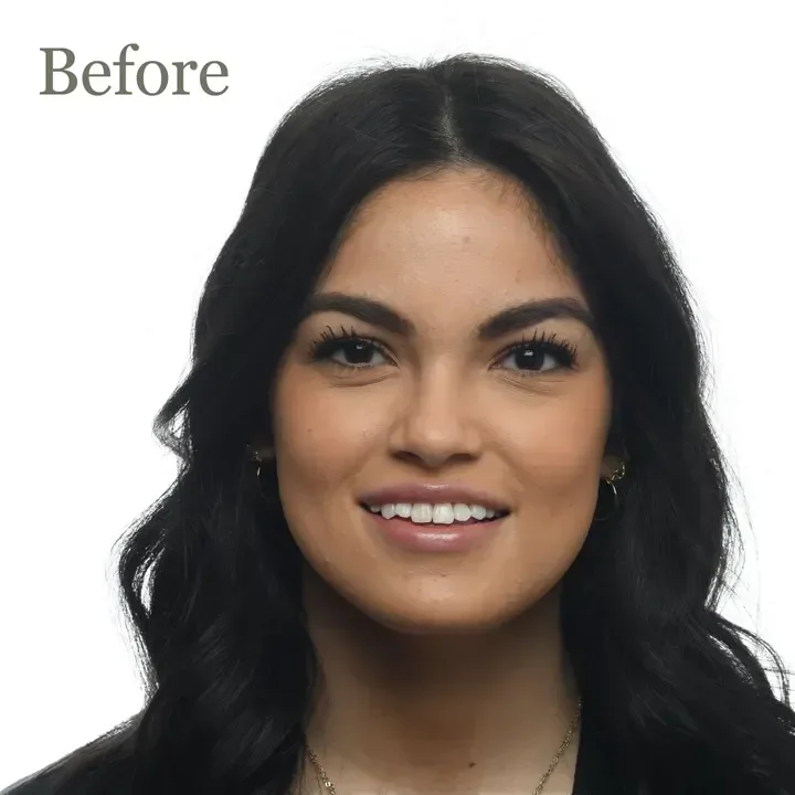 Teeth-Alignment-d4e1c2e6-1000h Teeth-Alignment-d4e1c2e6-1000h