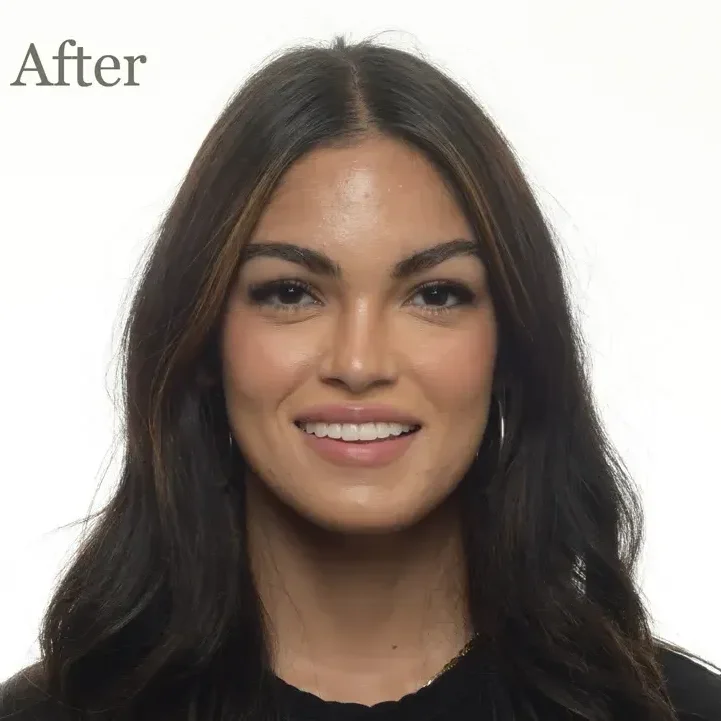 Teeth-Alignment-dc939d06-1000h