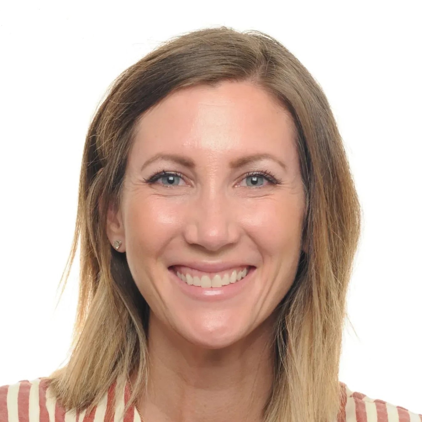 Before Gummy Smile Edit