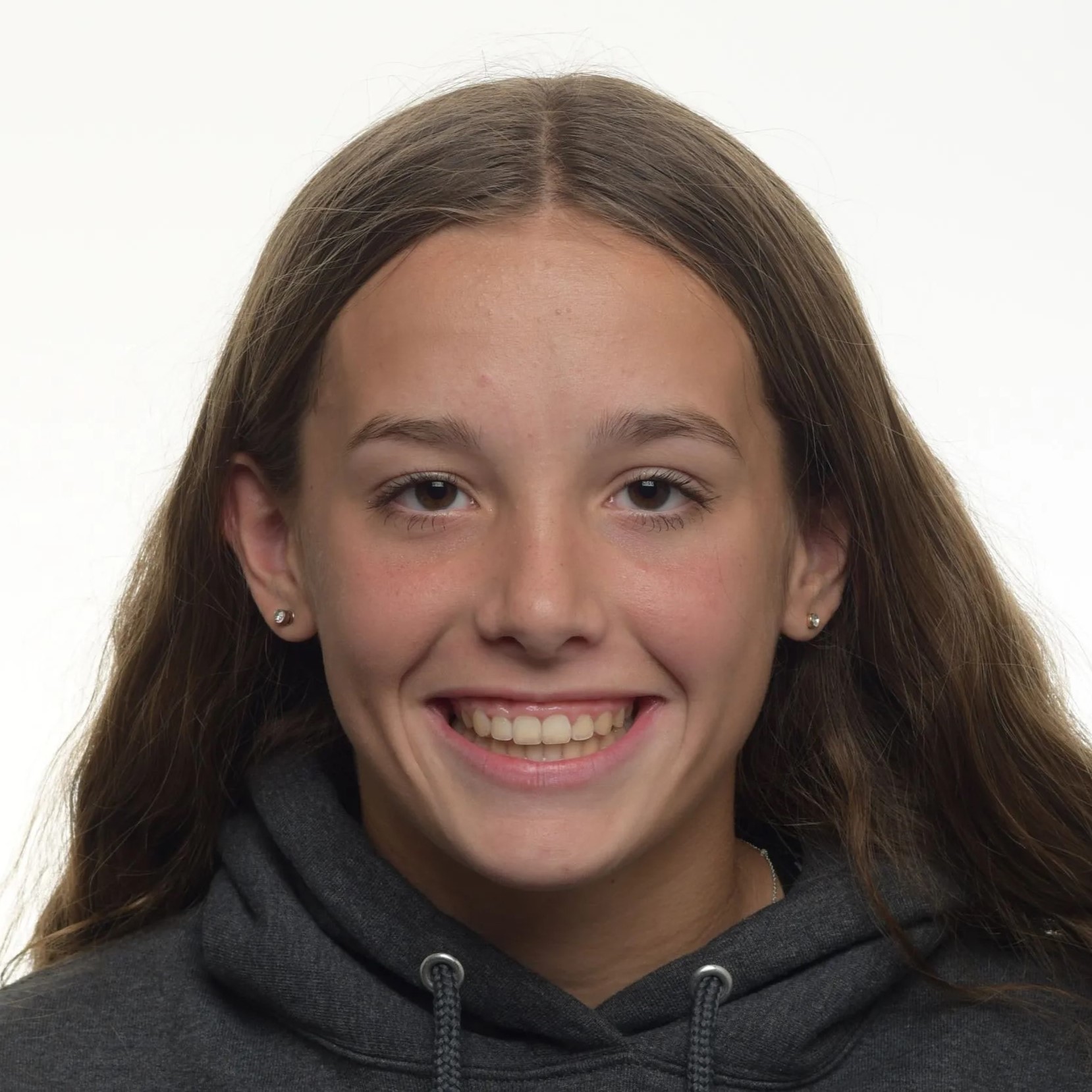 Initial Gingivectomy Edit