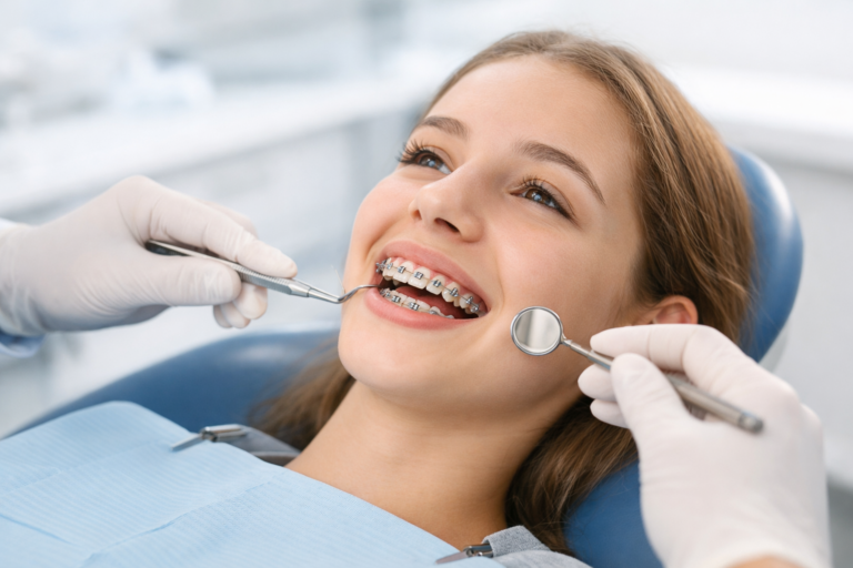 Do Braces Take a Long Time?