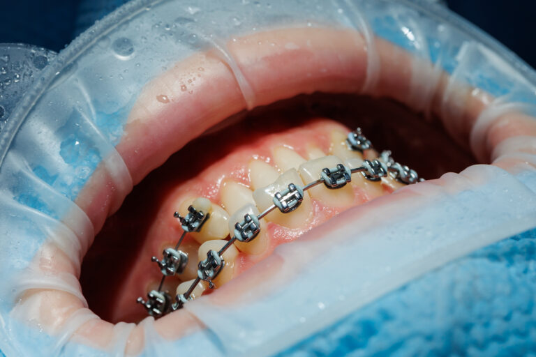 How Orthodontics Can Make You More Comfortable Every Day