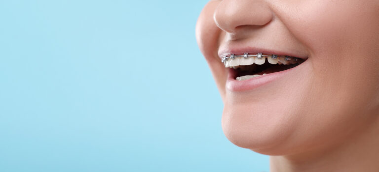 The Role of Orthodontics in Improving Natural Beauty Beyond Straight Teeth